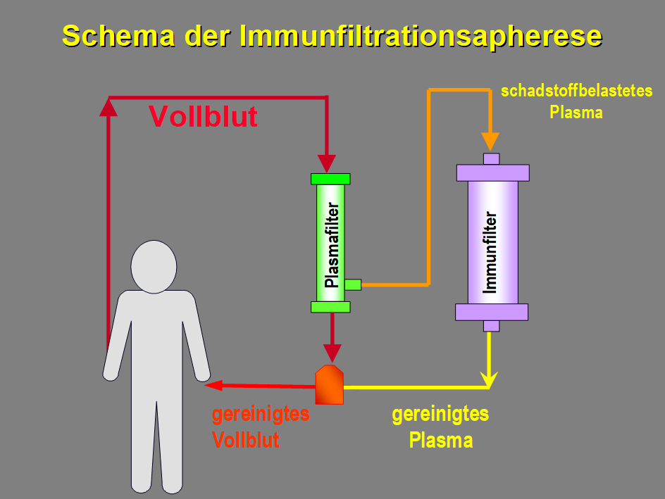 Schematische Beschreibung der Immunfiltrationsapherese